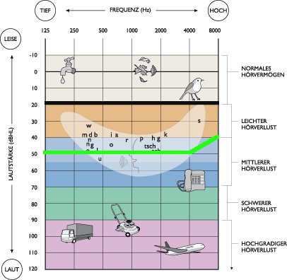 Grafik: Tonschwellenaudiogramm