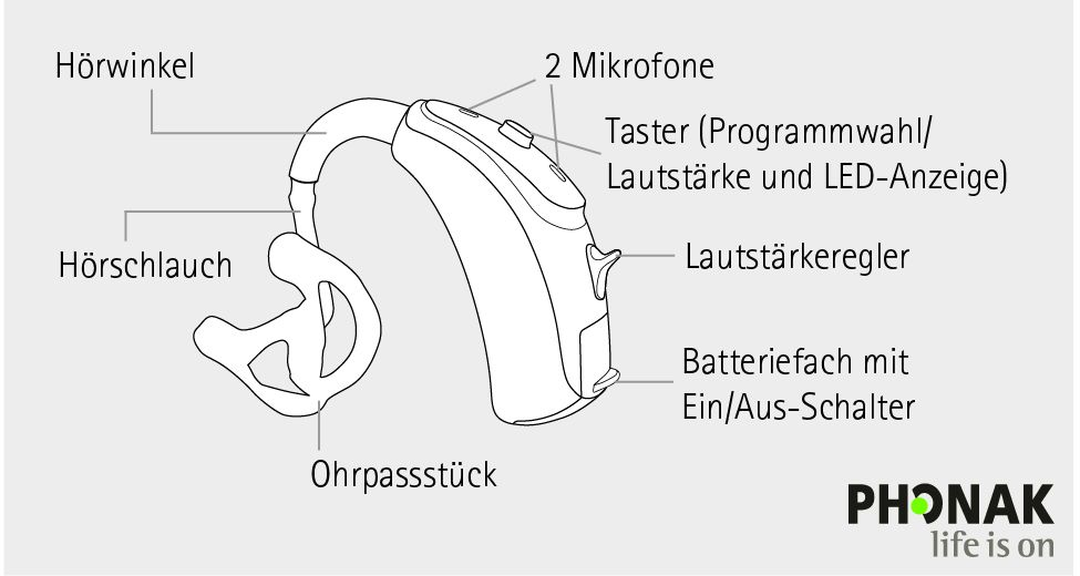 Aufbau und Teile eines HdO-Geräts